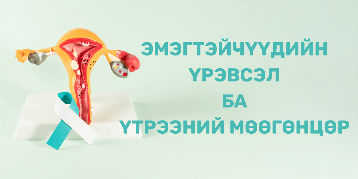 үтрээний мөөгөнцөр