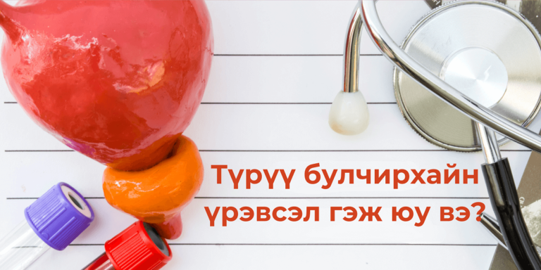 Түрүү булчирхайн үрэвсэл гэж юу вэ?